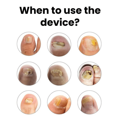 Orthovital Device (Official Retailer) [year]